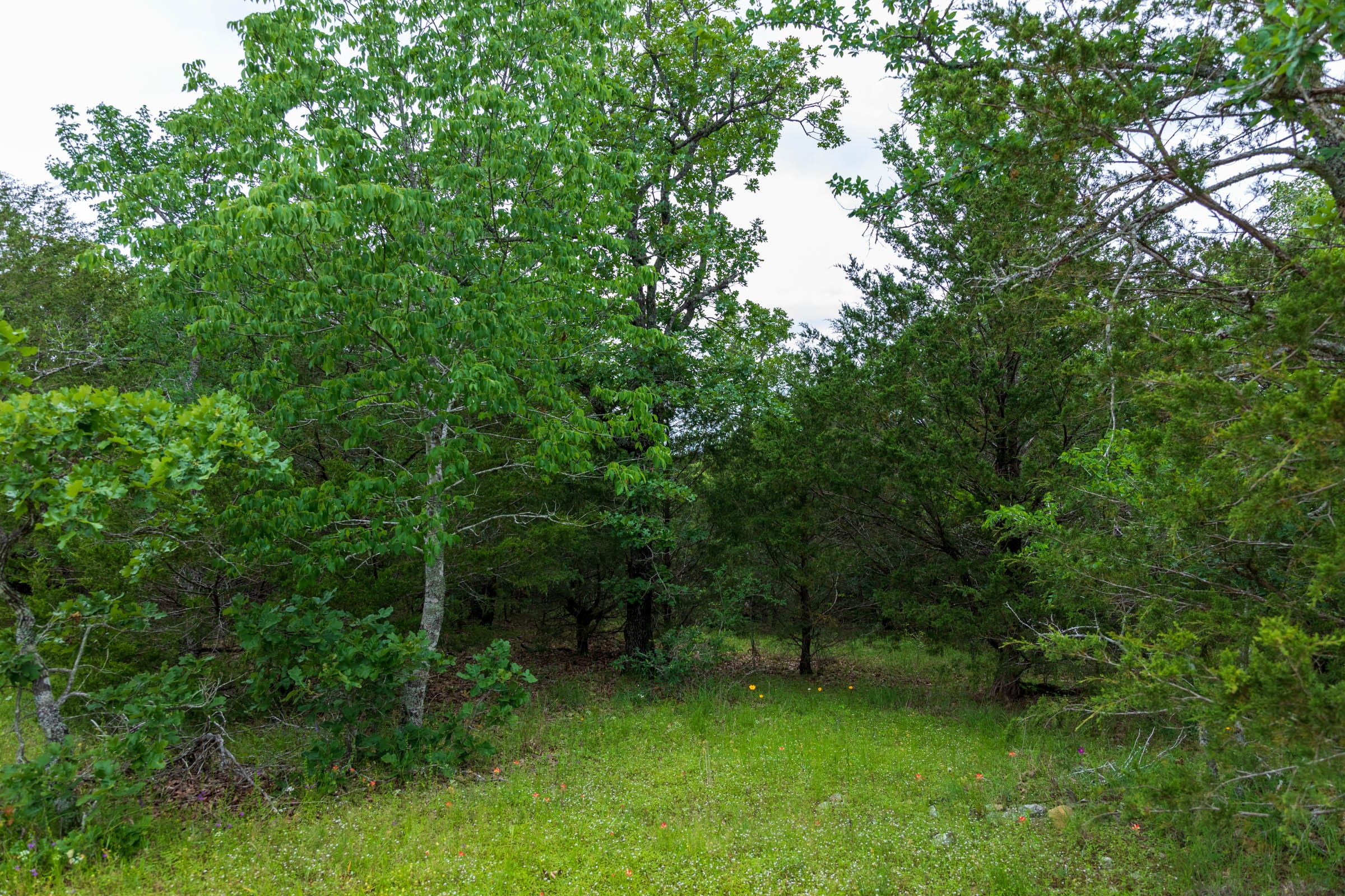 FLC-T31 tract image